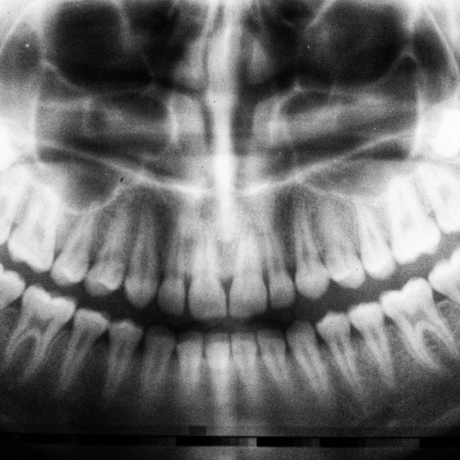 Digital dental radiograph used for initial records